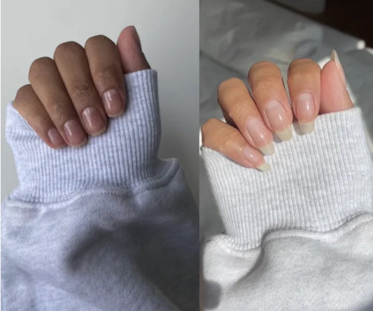 NAGELWACHSTUMSSERUM